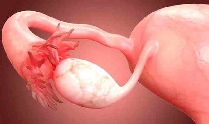 14-06-21-ll3py5wzkswc5i0